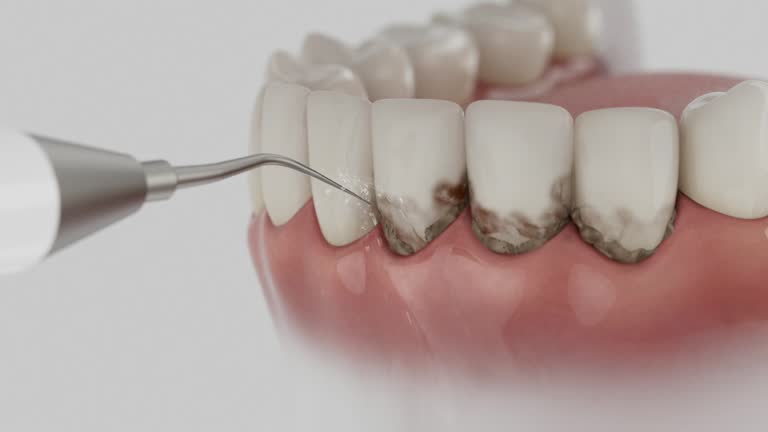 Trusted Emergency Dentist service in Caribou, ME - Dentist Open Now